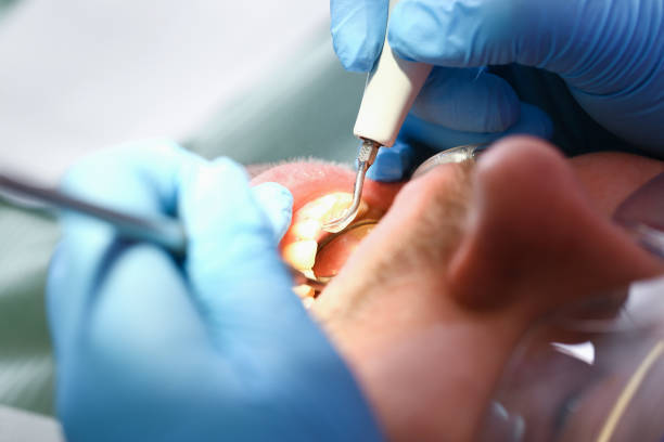 Best Emergency Care for Gum Disease in USA